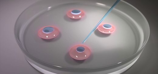 Explorando opciones de fertilización in vitro: Consejos para tomar decisiones informadas